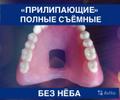 Революционные «Прилипающие Силиконовые» Съёмные Протезы №1